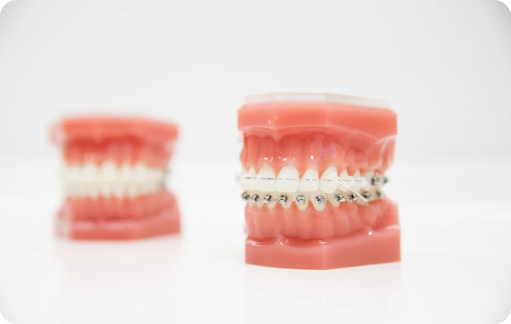 Modèle de mâchoire équipé d’un appareil multi-attaches et de son arc métallique