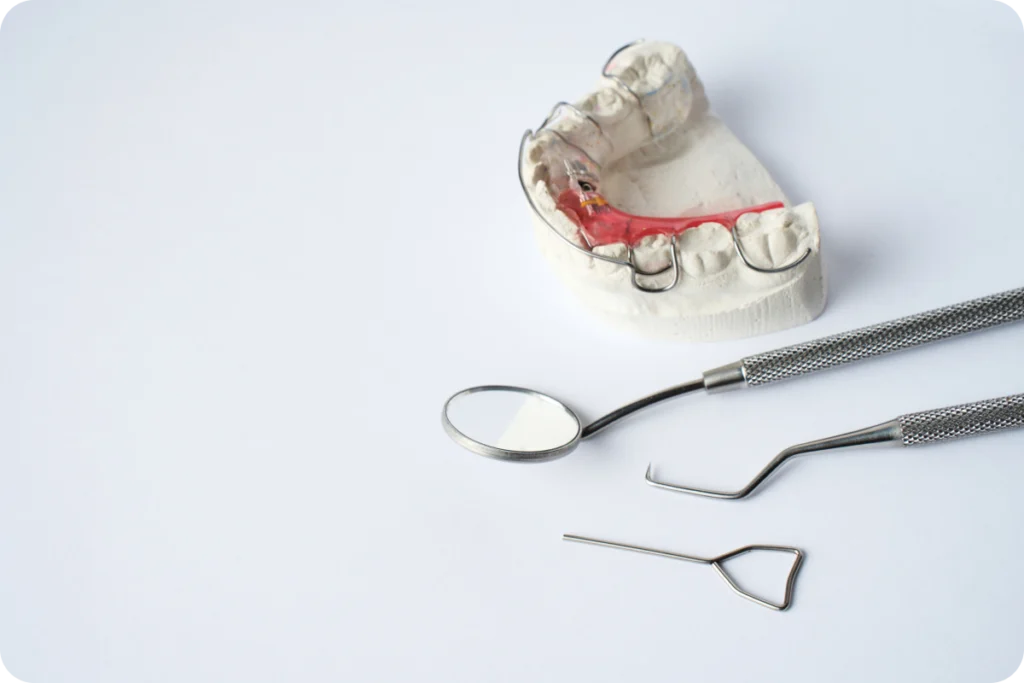 Plaques orthodontiques amovibles utilisées pour la correction dentaire chez l’enfant